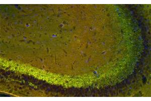 anti-Synapsin II (SYN2) antibody