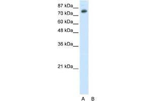 WB Suggested Anti-TSC22D2 Antibody Titration:  0. (TSC22D2 Antikörper  (N-Term))