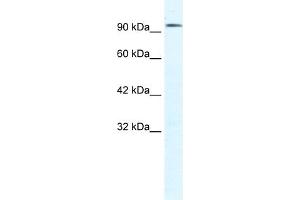 WB Suggested Anti-CLCN3 Antibody Titration:  1. (CLCN3 Antikörper  (C-Term))