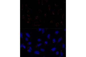 Immunofluorescence (IF) image for anti-TNF Receptor-Associated Protein 1 (TRAP1) (AA 445-704) antibody (ABIN1683134)