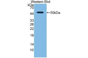 Western blot analysis of the recombinant protein. (PLAU Antikörper  (AA 17-432))