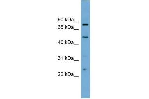 WB Suggested Anti-TFEB Antibody Titration: 0. (TFEB Antikörper  (Middle Region))