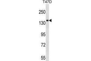 Western blot analysis in T47D cell line lysates (35ug/lane) using Myosin-Ie Antibody (N-term). (MYO1E Antikörper  (N-Term))