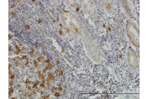 Immunoperoxidase of monoclonal antibody to RRM2 on formalin-fixed paraffin-embedded human stomach. (RRM2 Antikörper  (AA 1-110))