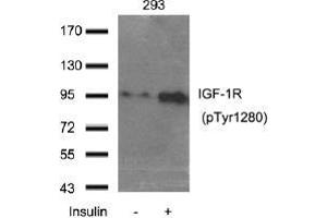 Western blot analysis of extract from 293 cells using IGF-1R (Phospho-Tyr1280). (IGF1R Antikörper  (pTyr1280))
