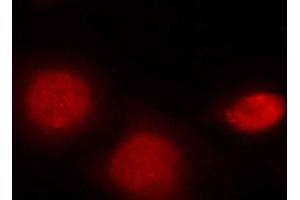 Immunofluorescence (IF) image for anti-Androgen Receptor (AR) (pSer213) antibody (ABIN3020082) (Androgen Receptor Antikörper  (pSer213))