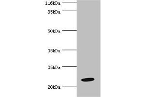 Western blot All lanes: NME6 antibody at 2 μg/mL + Hela whole cell lysate Secondary Goat polyclonal to rabbit IgG at 1/10000 dilution Predicted band size: 22, 14, 19 kDa Observed band size: 22 kDa