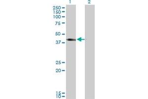 Western Blot analysis of SLC12A1 expression in transfected 293T cell line by SLC12A1 monoclonal antibody (M03), clone 4H4. (SLC12A1 Antikörper  (AA 80-172))