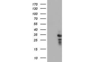 Western Blotting (WB) image for anti-Haloacid Dehalogenase-Like Hydrolase Domain Containing 1 (HDHD1) antibody (ABIN1498623) (HDHD1 Antikörper)