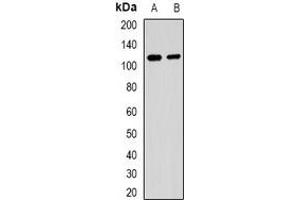 Western blot analysis of MALT1 expression in Raji (A), 293T (B) whole cell lysates. (MALT1 Antikörper)
