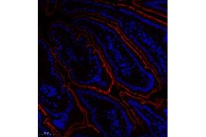 Immunofluorescence of paraffin embedded mouse duodenum using Treh (ABIN7076006) at dilution of 1:650 (200x lens)