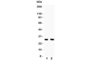 Western blot testing of Olig1 antibody and Lane 1:  U87;  2: HeLa lysate