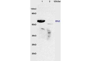 Lane 1: mouse lung lysates Lane 2: mouse brain lysates probed with Anti ROR Gamma/RORC/NR1F3 Polyclonal Antibody, Unconjugated (ABIN750298) at 1:200 in 4 °C. (RORC Antikörper)