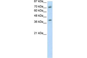 Western Blotting (WB) image for anti-Zinc Finger Protein 282 (ZNF282) antibody (ABIN2461700) (ZNF282 Antikörper)