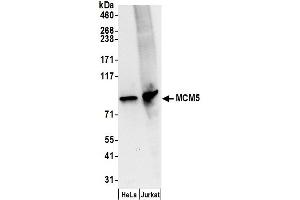 Western Blotting (WB) image for anti-Minichromosome Maintenance Complex Component 5 (MCM5) (AA 1-50) antibody (ABIN7454594) (MCM5 Antikörper  (AA 1-50))