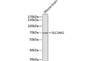 Western blot analysis of extracts of Mouse brain using SLC34A1 Polyclonal Antibody at dilution of 1:1000.