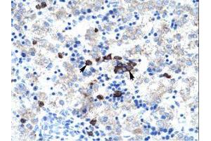 Image no. 1 for anti-Activator of Basal Transcription 1 (Abt1) (AA 174-223) antibody (ABIN202142)