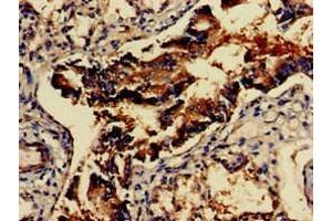 Immunohistochemistry of paraffin-embedded human lung tissue using ABIN7153954 at dilution of 1:100 (GAD65 Antikörper  (AA 1-82))