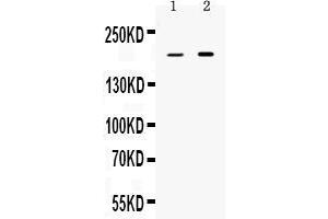 Western blot analysis of Periplakin expression in rat stomach extract ( Lane 1) and HELA whole cell lysates ( Lane 2).