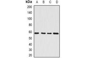 Western blot analysis of SerRS expression in HepG2 (A), Hela (B), mouse kidney (C), rat brain (D) whole cell lysates. (Seryl-tRNA Synthetase (SARS) Antikörper)