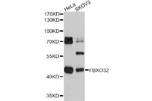 Western blot analysis of extracts of various cell lines, using FBXO32 antibody (ABIN1872667) at 1:2000 dilution. (FBXO32 Antikörper)