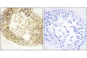 Immunohistochemistry (IHC) image for anti-Chromosome 2 Open Reading Frame 40 (C2orf40) (AA 41-90) antibody (ABIN2889756) (C2orf40 Antikörper  (AA 41-90))