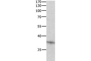 Western Blot analysis of Jurkat cell using DUSP12 Polyclonal Antibody at dilution of 1:500 (DUSP12 Antikörper)