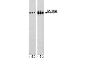 Western blot analysis of NF-kappaB p65 (pS529) in transformed human epithelioid carcinoma. (NFkB Antikörper  (pSer529))