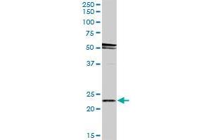 RAB31 MaxPab rabbit polyclonal antibody. (RAB31 Antikörper  (AA 1-195))