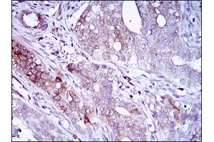 Immunohistochemistry (IHC) image for anti-CD22 Molecule (CD22) (AA 621-725) antibody (ABIN1724888)
