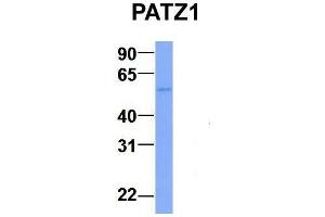 Host:  Rabbit  Target Name:  PATZ1  Sample Type:  Human Adult Placenta  Antibody Dilution:  1. (PATZ1 Antikörper  (N-Term))
