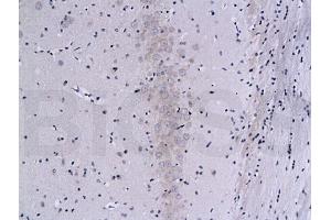 Formalin-fixed and paraffin embedded rat brain labeled with Mouse Anti-Calcineurin A/PP-2B alpha 1 Polyclonal Antibody (ABIN723890), Unconjugated 1:200 followed by conjugation to the secondary antibody and DAB staining (Calcineurin A Antikörper  (AA 15-80))
