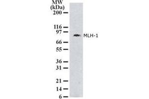 Image no. 1 for anti-MutL Homolog 1 (MLH1) (AA 387-403) antibody (ABIN208109) (MLH1 Antikörper  (AA 387-403))