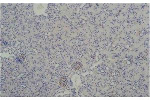 Immunohistochemistry of paraffin-embedded Mouse kidney tissue using TBP Monoclonal Antibody at dilution of 1:200. (TBP Antikörper)