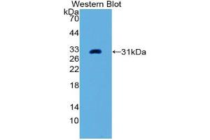 Western blot analysis of the recombinant protein. (PLAP Antikörper  (AA 68-313))