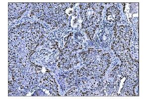 IHC analysis of Ki67 using anti-Ki67 antibody (ABIN7601100).