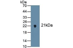 Detection of Recombinant NOX4, Mouse using Polyclonal Antibody to NADPH Oxidase 4 (NOX4) (NADPH Oxidase 4 Antikörper  (AA 210-578))