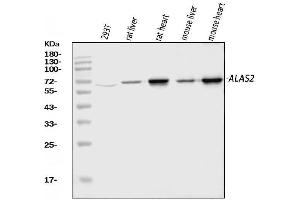 Western blot analysis of ALAS2/ASB using anti-ALAS2/ASB antibody (ABIN7599056).