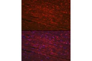 Immunofluorescence analysis of mouse heart using PG Rabbit pAb (ABIN6132481, ABIN6145500, ABIN6145501 and ABIN6223912) at dilution of 1:100 (40x lens). (PGAM2 Antikörper  (AA 1-253))
