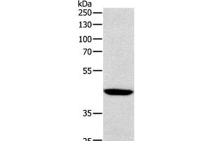 Western Blot analysis of Human lymphoma tissue using SOX-7 Polyclonal Antibody at dilution of 1:1100 (SOX7 Antikörper)