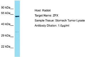 Host: Rabbit Target Name: ZFX Sample Type: Stomach Tumor lysates Antibody Dilution: 1. (ZFX Antikörper  (C-Term))