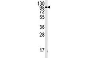 Western blot analysis of FGFR antibody and K562 lysate. (FGFR1 Antikörper  (AA 132-161))