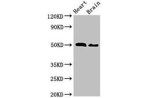 Western Blot Positive WB detected in: Mouse heart tissue, Mouse brain tissue All lanes: VPS4B antibody at 2. (VPS4B Antikörper  (AA 1-117))