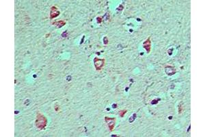 ATG8 Immunohistochemistry.