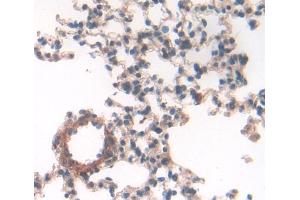 Used in DAB staining on fromalin fixed paraffin- embedded lung tissue (GM-CSF Antikörper  (AA 19-141))