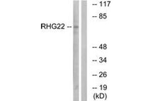 Western blot analysis of extracts from K562 cells, using RHG22 Antibody. (ARHGAP22 Antikörper  (AA 565-614))
