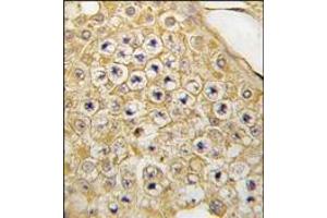 Immunohistochemistry (Paraffin-embedded Sections) (IHC (p)) image for anti-PDZ Binding Kinase (PBK) (C-Term) antibody (ABIN359330)