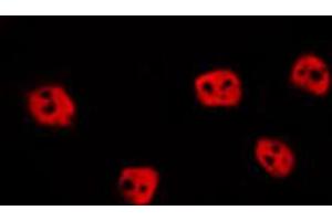 ABIN6274015 staining HepG2 by IF/ICC. (EPAS1 Antikörper  (Internal Region))