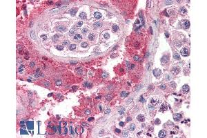 Immunohistochemistry (IHC) image for anti-SET Nuclear Oncogene (SET) (N-Term) antibody (ABIN184618)