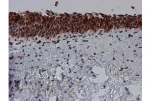 Image no. 11 for anti-Spermidine/Spermine N1-Acetyltransferase 2 (SAT2) antibody (ABIN1500807)